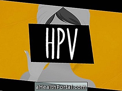 HPV a análny sex